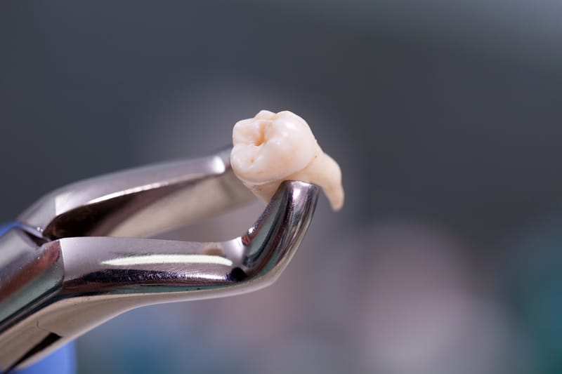 pliers with a molar tooth