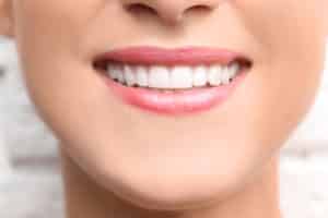 close-up of a woman's smile with perfect teeth