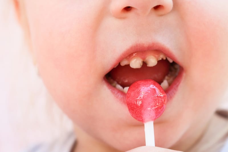 Child Eats Candy Girl Has Caries On Teeth Dr Ania Mohelicki Site