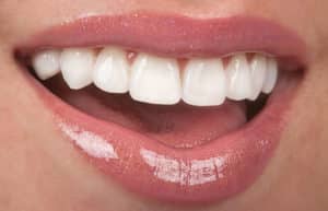 A close-up view of a woman's mouth that has beautiful, healthy, straight teeth and clear gloss to highlight her lips.
