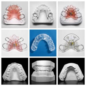 A collage of 9 images that are orthodontic retainers, invisalign aligners, braces and more on model teeth. 
