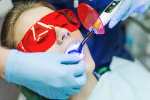 laser dental cleanings