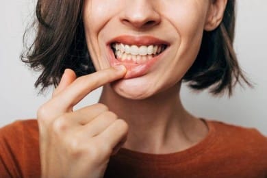 A woman pulling down her lip to show gum recession